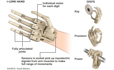 Bionic hand hits retail market
