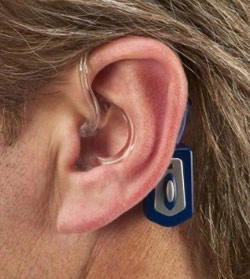 Высокие технологии для слабо слышащих людей