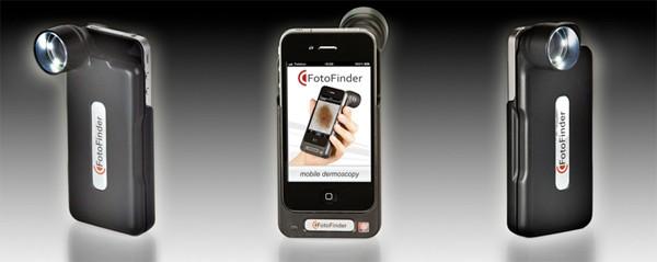 Handyscope offers an intimate look of your skin via iPhone Handyscope offers an intimate look of your skin via iPhone