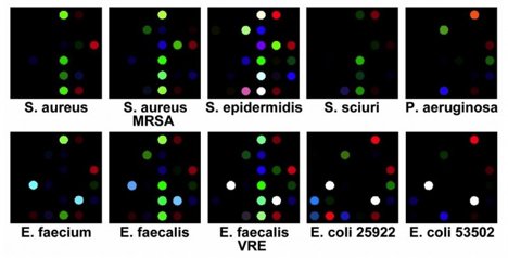 Bacteria detecting cards Bacteria detecting cards