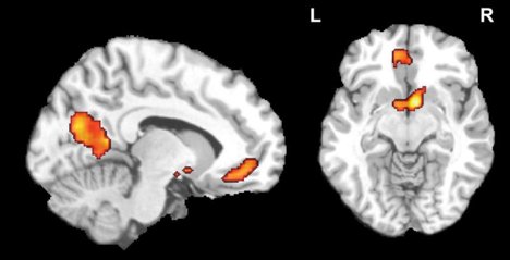 Teen brain data used to predict the success of a pop song Teen brain data used to predict the success of a pop song