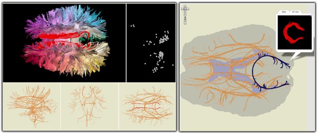 2D brain map 2D brain map