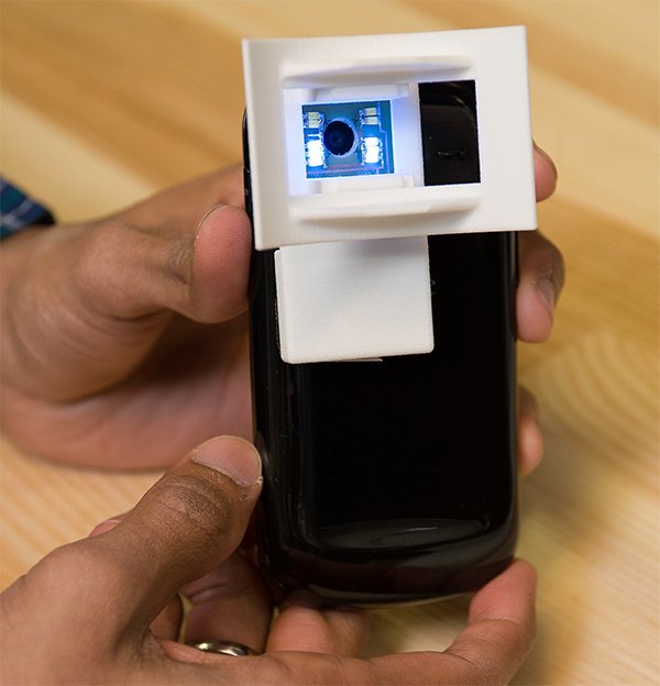OScan a Smartphone Based Screening Device for Oral Cancer OScan a Smartphone Based Screening Device for Oral Cancer